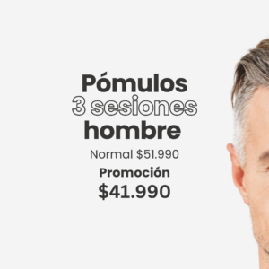 Pómulos - Hombre