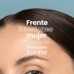 Frente - Mujer