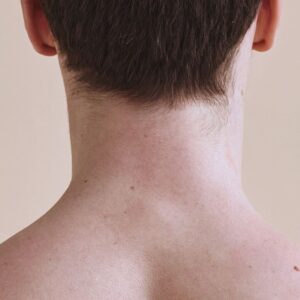 Cuello posterior - Hombre